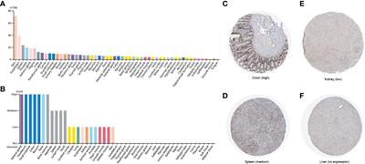 Pan-cancer analysis reveals potential of FAM110A as a prognostic and immunological biomarker in human cancer